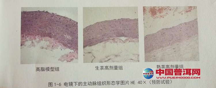 普洱茶