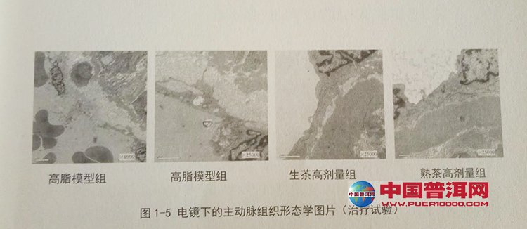 普洱茶