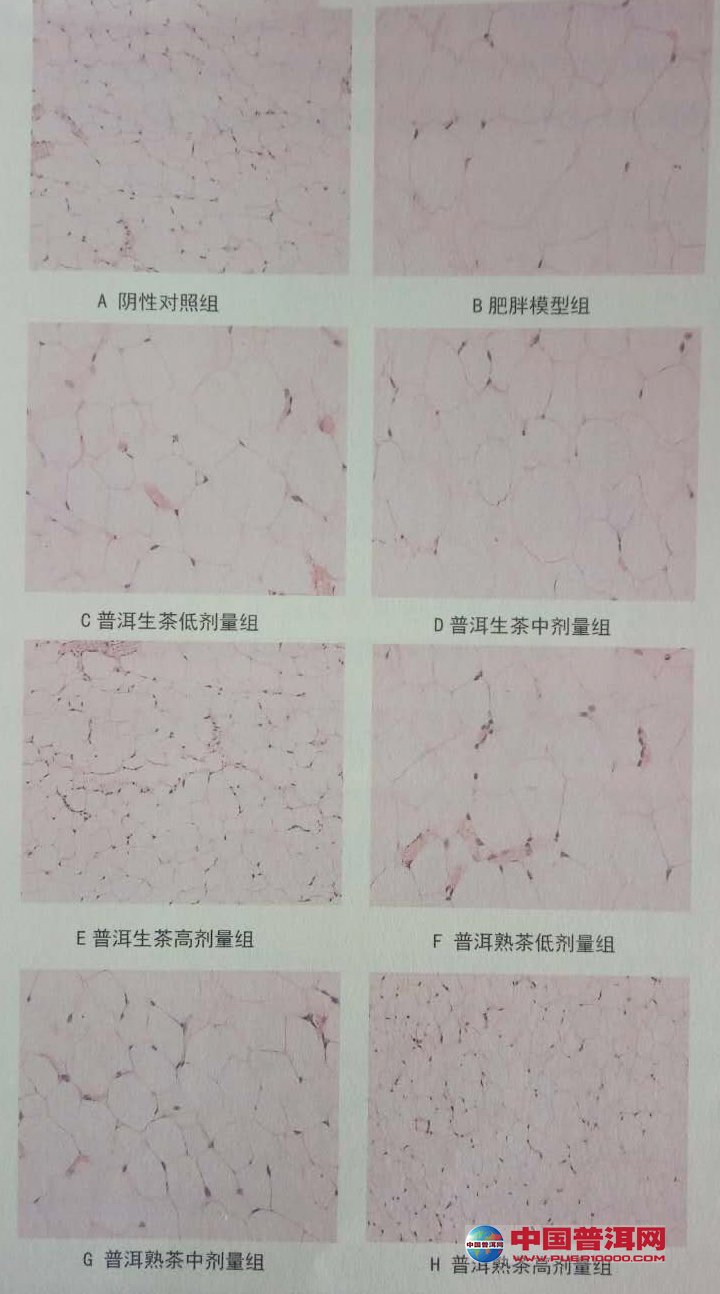 普洱茶